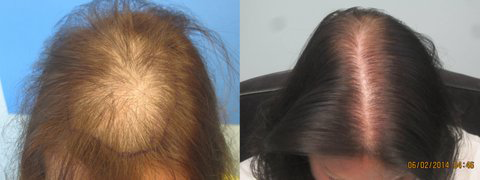 before-and-after-pic-006