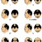 5 Categories of Hair Loss
